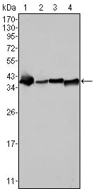 Nucleophosmin